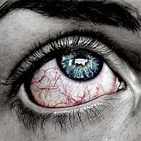 رایج ترین علل قرمزی چشم